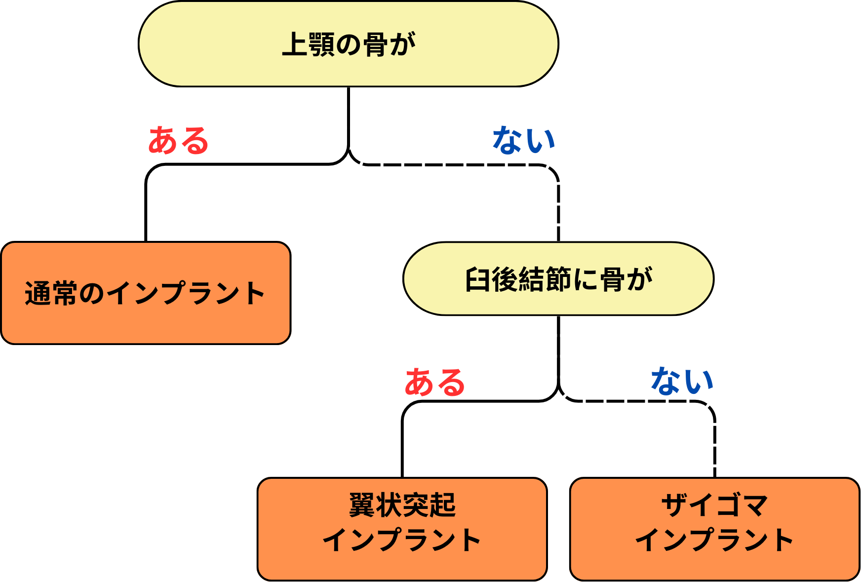 通常インプラント・ザイゴマインプラント・翼状突起インプラントの選び方