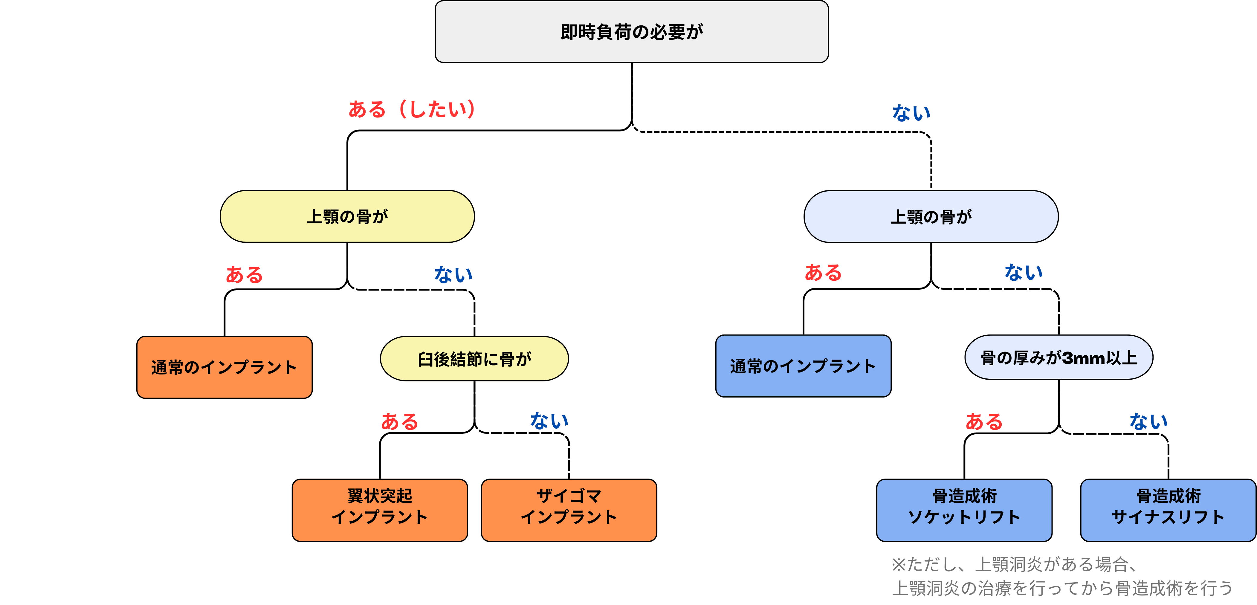 上顎臼歯部インプラント治療のフロートチャート