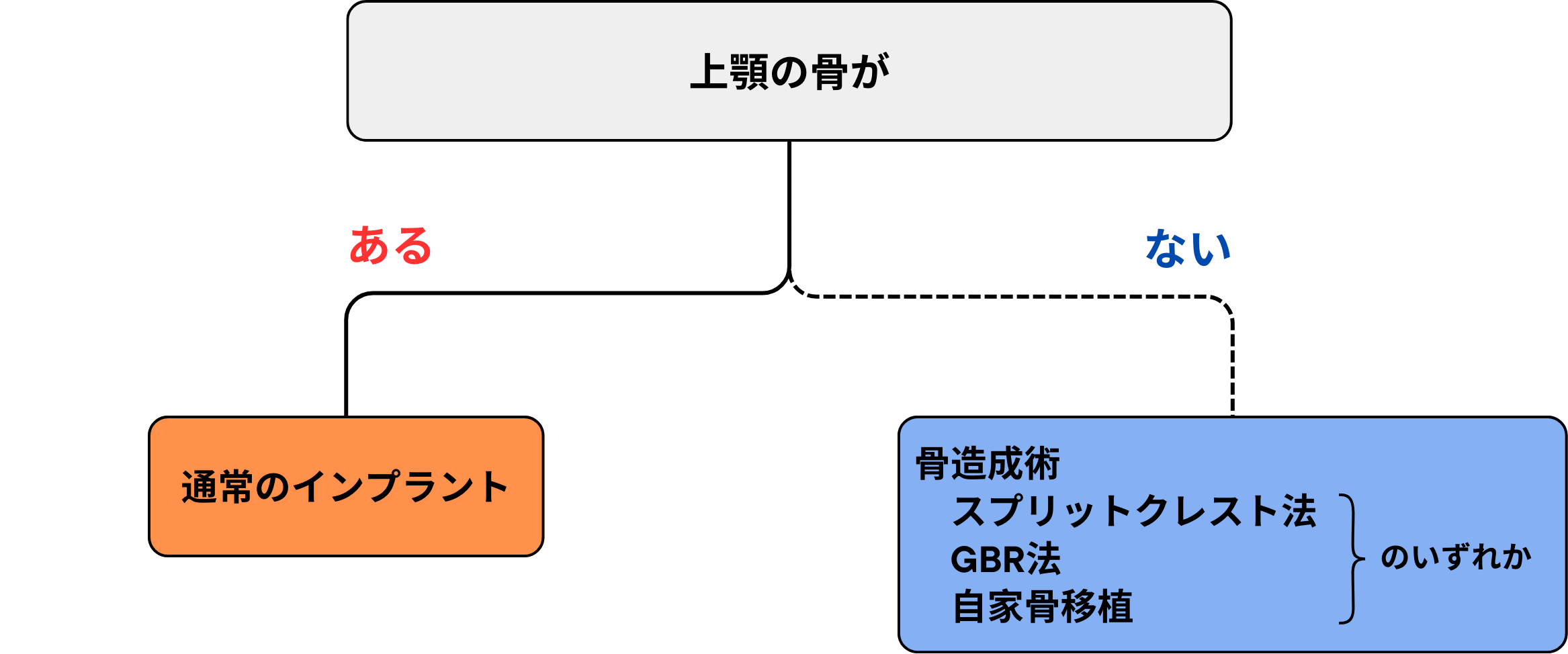 上顎・臼歯部以外のインプラント治療のフロートチャート